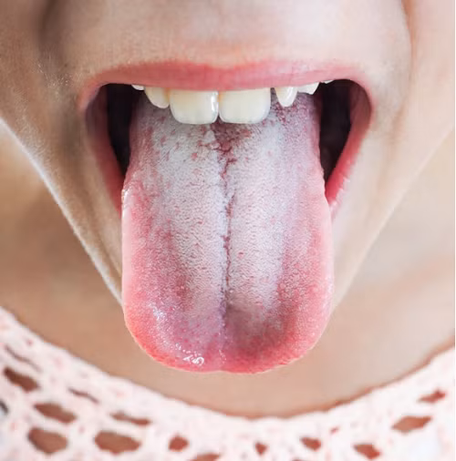 Giật mình dấu hiệu cơ thể mắc bệnh hiểm, triệu người bỏ qua - Hình 4