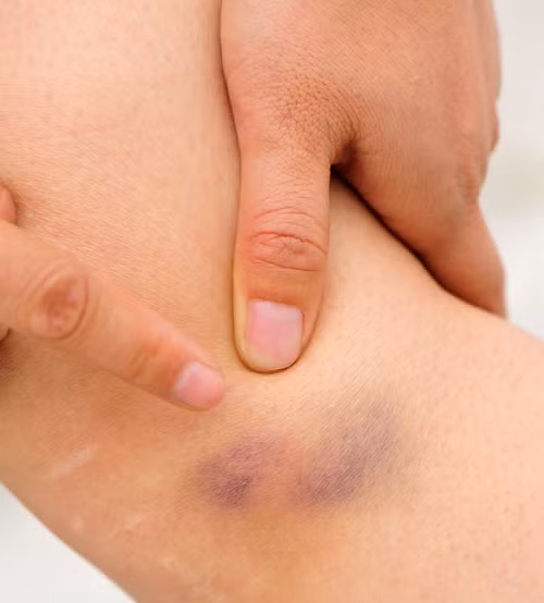 Giật mình dấu hiệu cơ thể mắc bệnh hiểm, triệu người bỏ qua - Hình 9