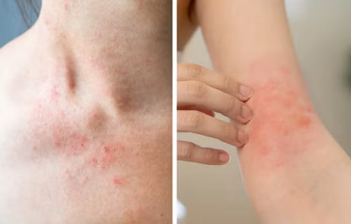 Giật mình dấu hiệu cơ thể mắc bệnh hiểm, triệu người bỏ qua - Hình 5