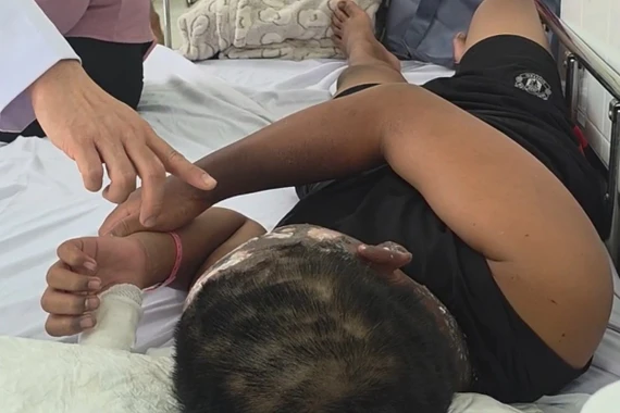 Cảnh báo nguy hiểm từ tai nạn pháo nổ dịp Tết