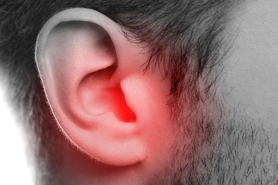 Phẫu thuật kịp thời giúp bảo vệ thính lực trẻ mắc cholesteatoma