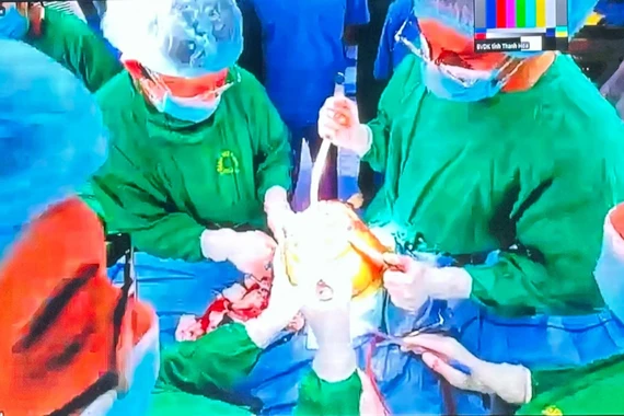 Phẫu thuật thay khớp gối toàn phần theo phương pháp bảo tồn cơ cho cụ bà