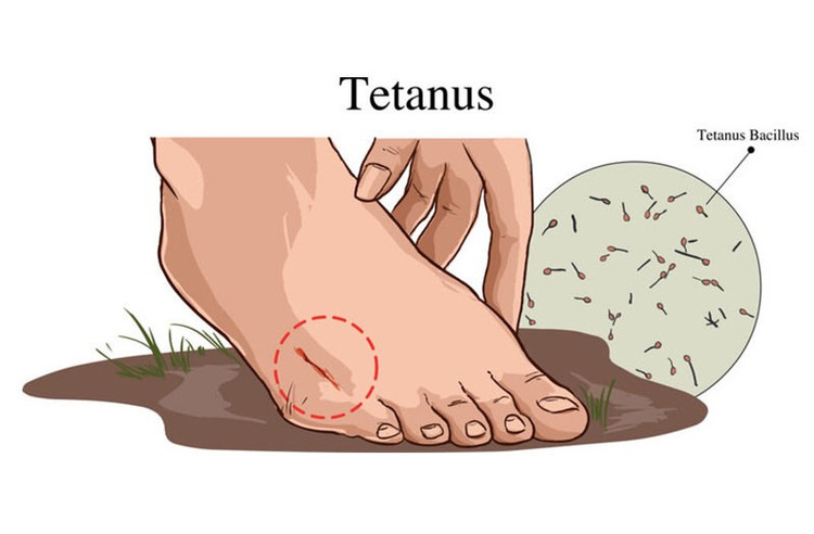 Hình minh hoạ. Hình minh hoạ.