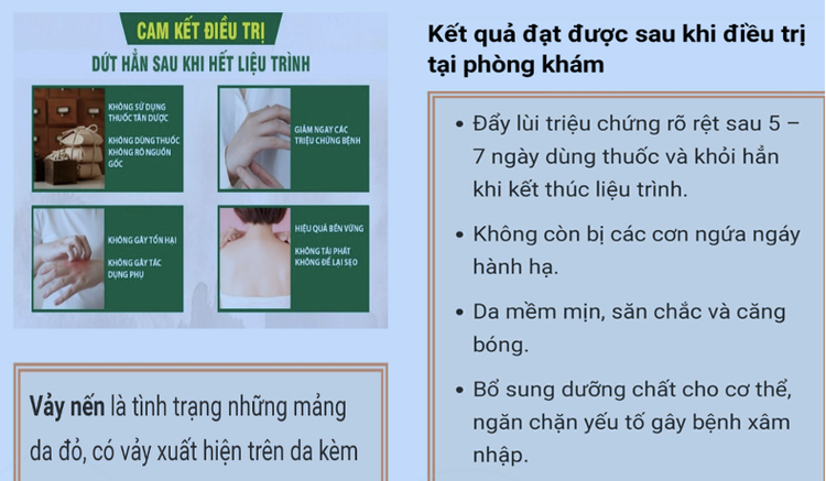 Wedsite dalieudaiphuc.net quảng cáo trị khỏi hẳn bệnh vảy nến