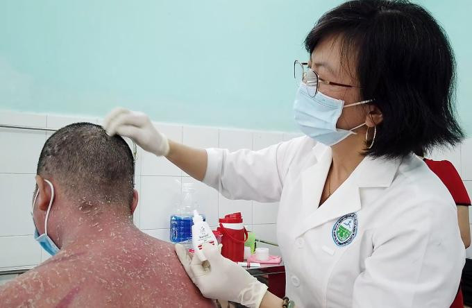 Bệnh nhân bị vảy nến biến chứng nặng