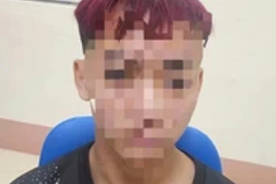 Thiếu niên 15 tuổi hiếp dâm bé 12 tuổi ở Lào Cai sẽ bị xử lý ra sao?