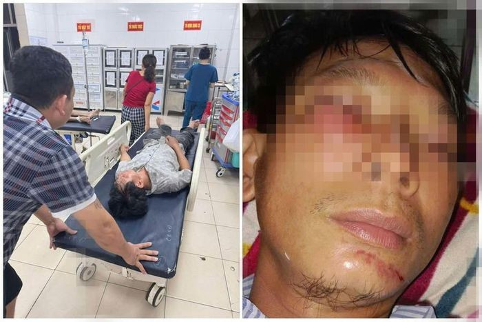 Anh H. bị chấn thương nặng đang được điều trị, theo dõi tại Bệnh viện Đa khoa Hà Tĩnh.