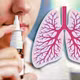 Vaccine xịt mới giúp chống lại bệnh lao và tăng hiệu quả điều trị