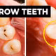 Phát minh gel tái tạo men răng giúp bảo vệ sức khỏe răng miệng