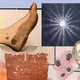 Công nghệ nano kích hoạt ánh sáng giúp điều trị vết thương mãn tính hiệu quả