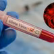 Bộ Y tế cảnh báo phòng chống bệnh do virus Ebola tại Việt Nam