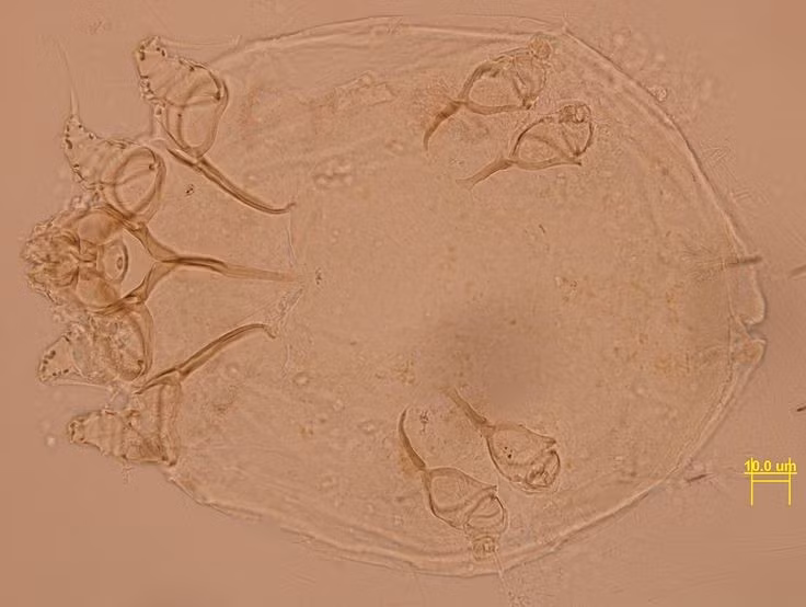 Lây lan nhanh qua tiếp xúc gần. Bệnh ghẻ dễ lây qua tiếp xúc da kề da, đặc biệt trong môi trường đông người như ký túc xá, gia đình hoặc cơ sở chăm sóc. Việc dùng chung quần áo, chăn màn cũng có thể làm lây nhiễm. Ảnh: Pinterest.