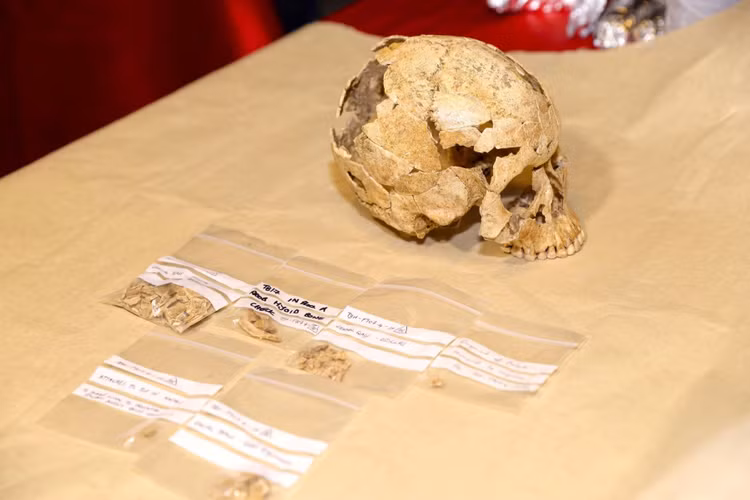 Nguyên nhân tử vong người đàn ông được xác định có chấn thương ở phần xương sườn bởi một công cụ có đầu nhọn làm bằng đá thạch anh đâm vào sau đó gây nhiễm trùng. Ảnh: Vietnamnet.