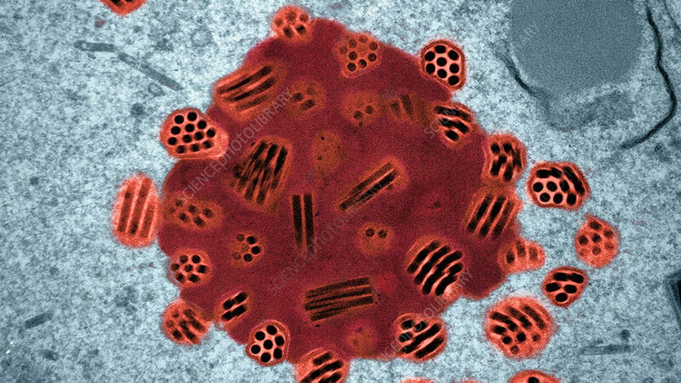 4. Virus ký sinh baculovirus khiến sâu bướm leo lên cao trước khi chết. Loại virus này tái lập hệ gene và phá vỡ mô não, khiến vật chủ leo lên cao, tan rã và phát tán virus xuống đất qua nước mưa – một chiến lược phát tán hiệu quả. Ảnh: igbmc.fr.