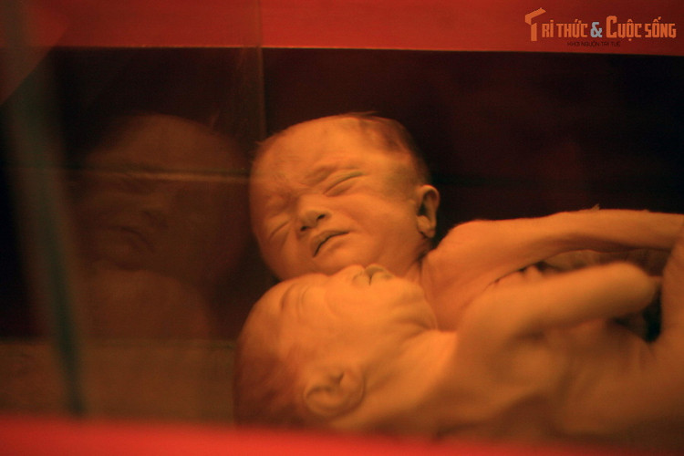 10 dieu bat ngo ve Bao tang Chung tich Chien tranh o TP HCM-Hinh-6