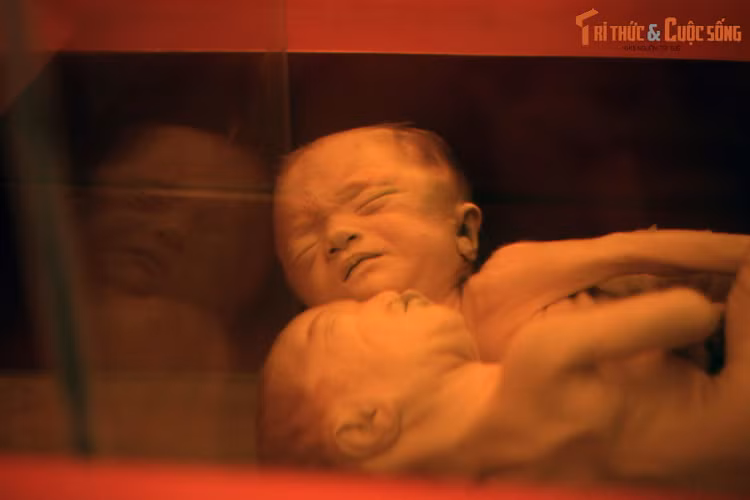 10 dieu bat ngo ve Bao tang Chung tich Chien tranh o TP HCM-Hinh-6