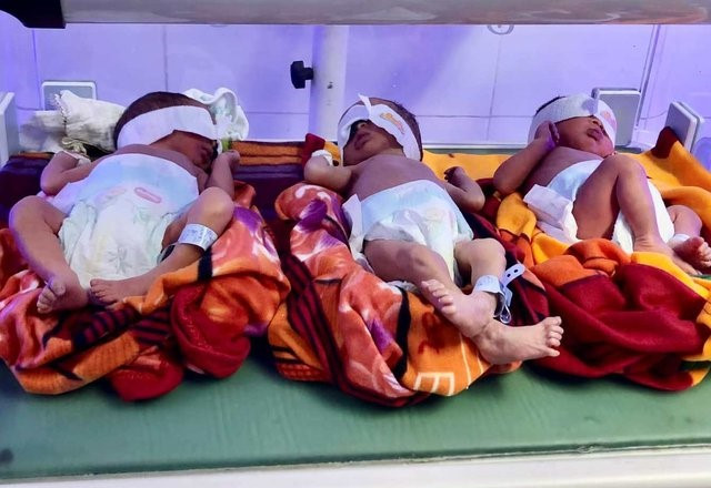 3 bé trai khỏe mạnh sau ca phẫu thuật. Ảnh: Thanh niên