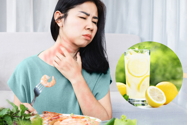 Uống nước chanh giúp hệ tiêu hóa khỏe mạnh, giảm dị ứng hải sản Uống nước chanh giúp hệ tiêu hóa khỏe mạnh, giảm dị ứng hải sản