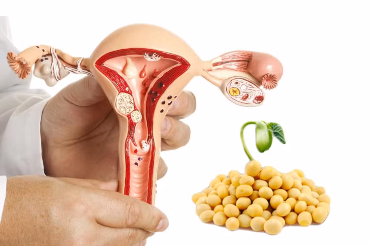 Nhiều bằng chứng khoa học cho thấy mầm đậu nành không làm tăng kích thước khối u mà còn giúp giảm nguy cơ ung thư