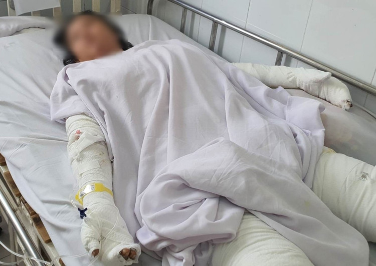 Chị H. đang được điều trị tại Khoa Bỏng và Phẫu thuật tạo hình, Bệnh viện Chợ Rẫy. Ảnh VietNamnet