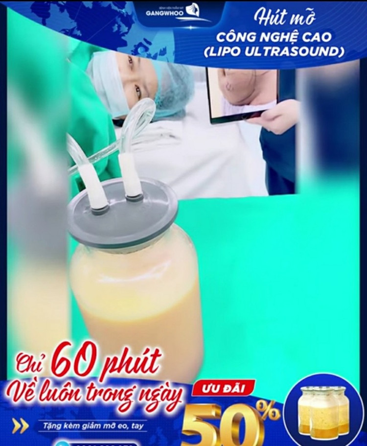 Quảng cáo hút mỡ bụng trên website của BVTM GangWhoo