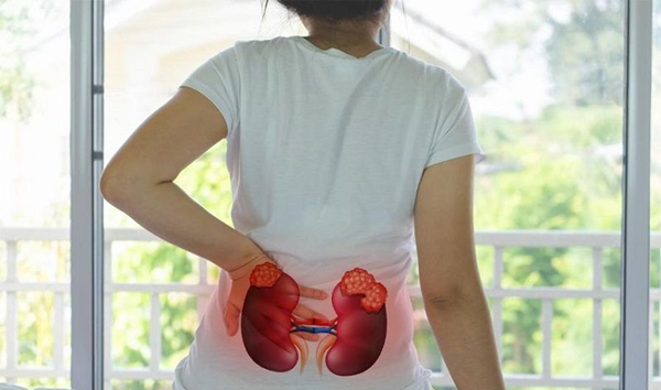 Người bị suy thận độ 3 thường xuất hiện triệu chứng đau thắt lưng - hông