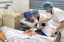 Máy cưa, thang máy nghiền nát bàn tay: Chậm tái lập máu, nguy cơ mất ngón
