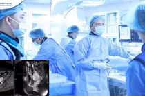 Lần đầu tại Việt Nam điều trị lạc nội mạc tử cung bằng sóng cao tần