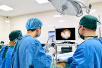 Nhiễm khuẩn tiết niệu tái đi tái lại vì sỏi san hô chiếm toàn bộ đài bể thận