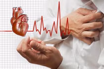 550 người Việt Nam tử vong do tim mạch mỗi ngày, cách gì phòng tránh