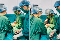 Đau bụng, ra máu cuối thai kỳ: Hai mẹ con nguy kịch vì 3 biến chứng sản khoa
