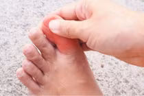 Đau và nóng đỏ ngón chân, cụ bà 93 tuổi nguy kịch vì hẹp tắc mạch máu
