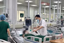 Cứng hàm trở lại sau 20 ngày điều trị uốn ván vì mảnh tre 3 cm còn sót