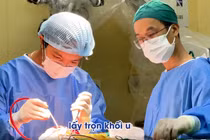 U não to như quả quýt được phát hiện tình cờ sau tai nạn