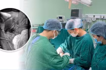 Mang thai sớm sau sinh mổ, sản phụ vỡ tử cung, thai lưu trong ổ bụng
