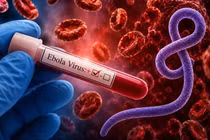 WHO cảnh báo khẩn về Ebola Bundibugyo tại châu Phi