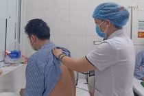 Tưởng ho thông thường, nhiều người trẻ để lao phổi tiến triển nặng