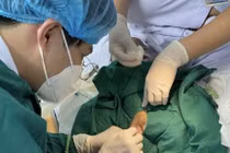 Bé 1 tháng tuổi suy đa cơ quan sau sốt, nôn, tiêu chảy