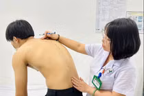 Tưởng đau do vận động quá mức, không ngờ viêm cột sống dính khớp