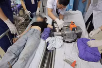 Vài giây bất cẩn khi dùng máy xay thịt, cô gái 19 tuổi phải cắt cụt bàn tay 