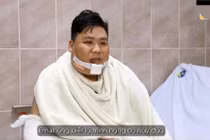 Thanh niên 130kg đa chấn thương nặng được cứu sống sau tai nạn giao thông