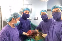 Đau âm ỉ lưng, nang thận… dễ mắc ung thư
