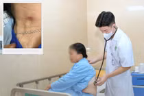 Vết loét 5 × 3 mm ở cổ hé lộ bệnh có thể gây suy đa cơ quan
