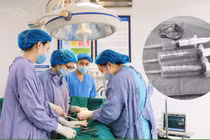 Lấy u buồng trứng phức tạp ở người bệnh đã cắt tử cung