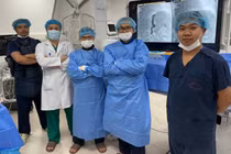 Lần đầu triển khai nút tắc tĩnh mạch, cứu ca xuất huyết dạ dày nguy kịch