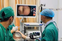 Đặt răng giả trong ly, người đàn ông uống nước rồi nuốt cả hàm răng giả