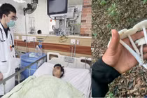 Ăn nấm hái trong rừng, nhiều người suy gan, suy đa tạng nguy kịch