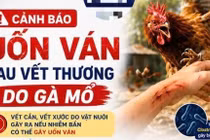 Cụ bà 86 tuổi cứng hàm, khó nuốt sau vết thương do gà mổ vì uốn ván