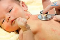 Lây thủy đậu từ mẹ, trẻ sơ sinh suy hô hấp cấp nguy kịch