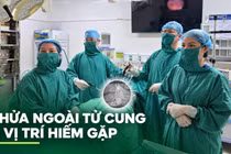 Chửa ngoài tử cung 'ẩn' giữa hai lớp dây chằng rộng